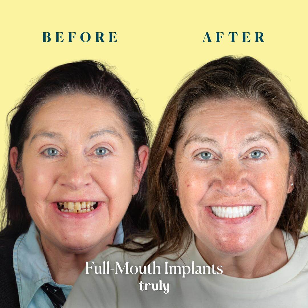 Before and after result 1