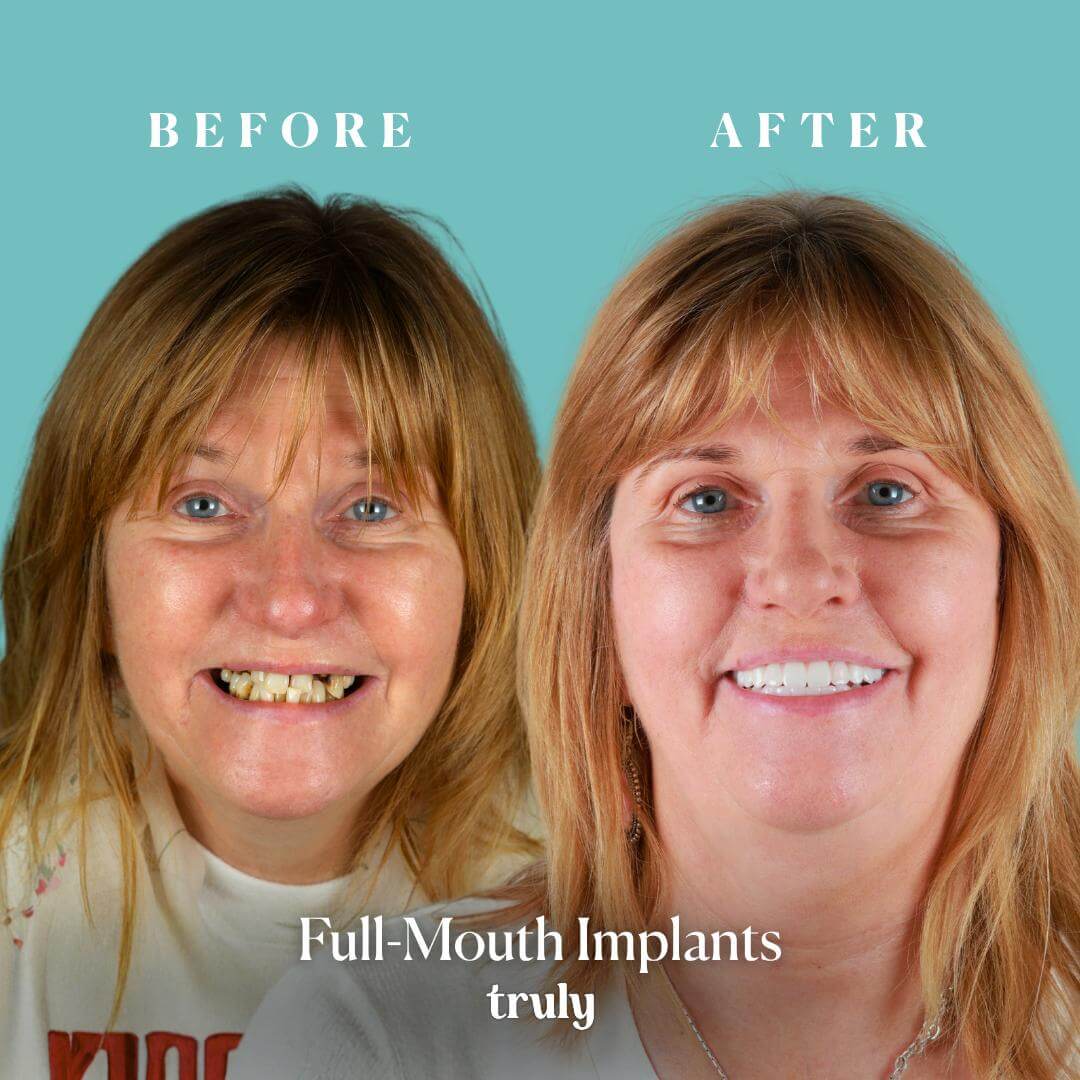 Before and after result 6