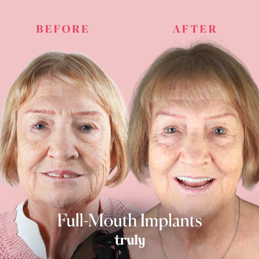 Before and after result 8