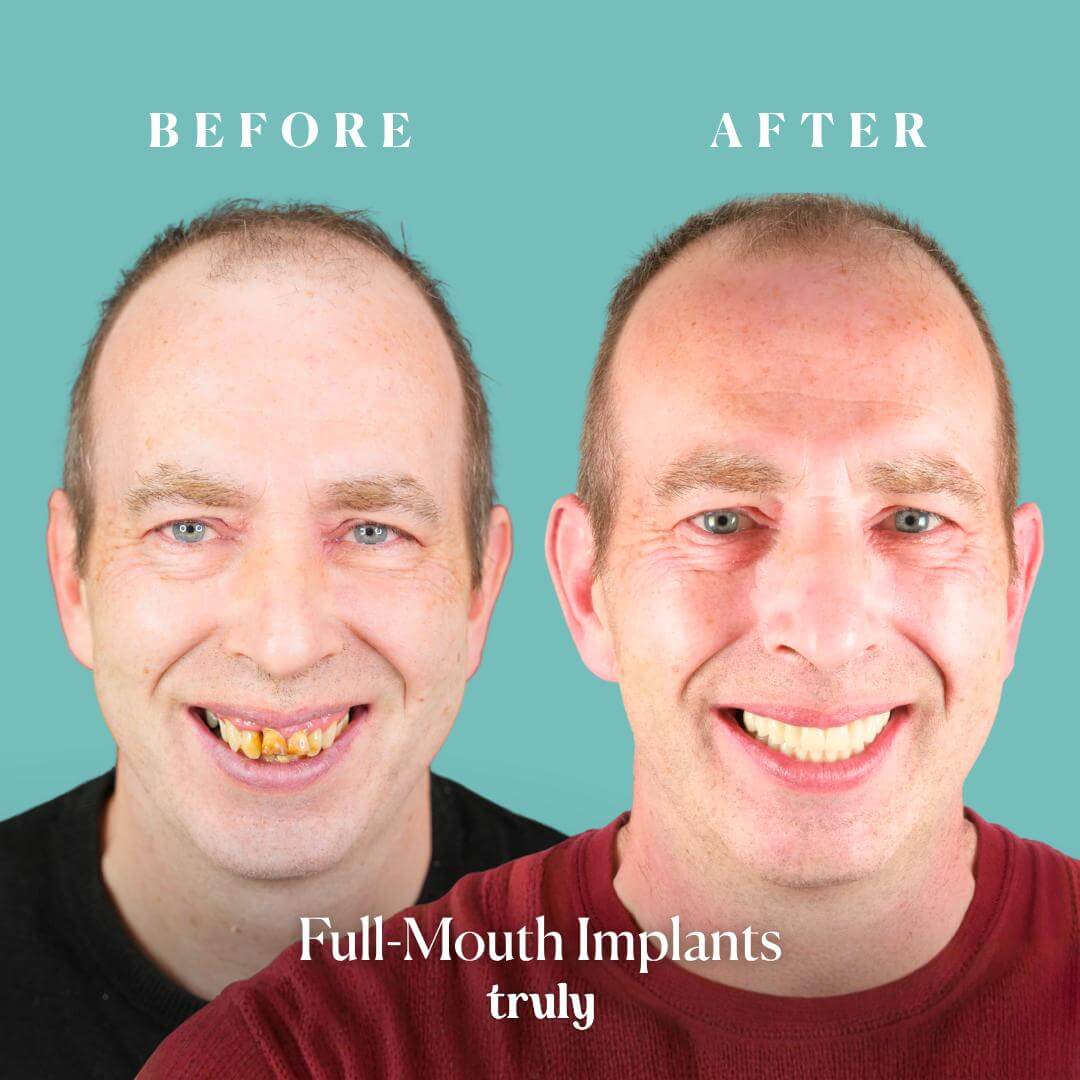 Before and after result 9