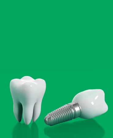 Our comprehensive breakdown of  <br> <em>TruSmile Full Mouth Implant Pricing</em>