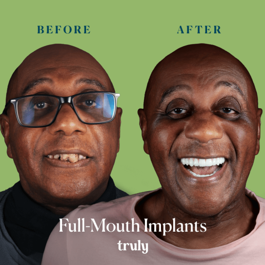 Implants