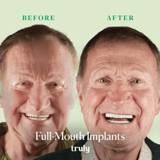 Implants