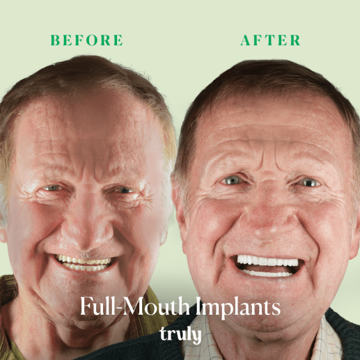 Implants