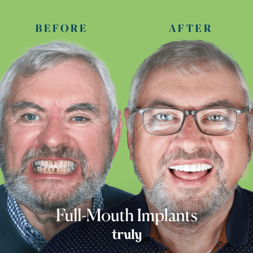 Implants